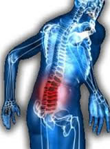 Canal Estrecho Lumbar